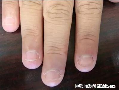 剪指甲、挖耳屎，这些日常小动作竟隐藏大危害！ - 金昌生活资讯 - 金昌28生活网 jinchang.28life.net